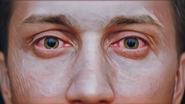 Глаза наркомана1 - Наркологическая клиника Флагман