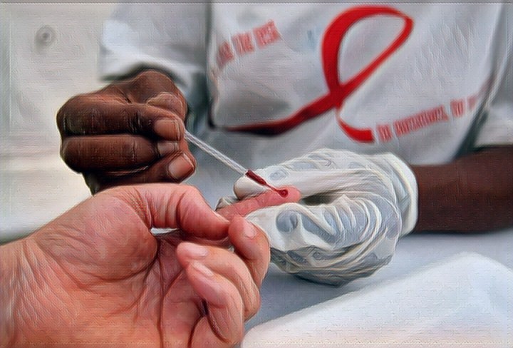 ВИЧ-инфекция у наркоманов: проявления и последствия - Наркологическая клиника