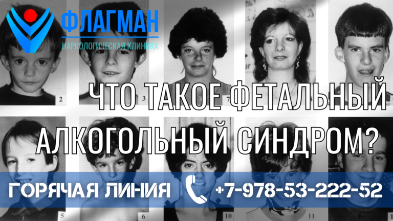 Что такое фетальный алкогольный синдром?