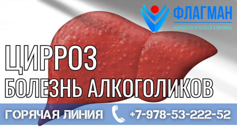 Цирроз – болезнь алкоголиков